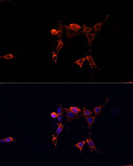 ERK1 / ERK2 Polyclonal Antibody