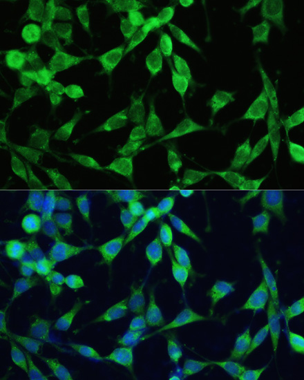 SMAD2/SMAD3 Polyclonal Antibody