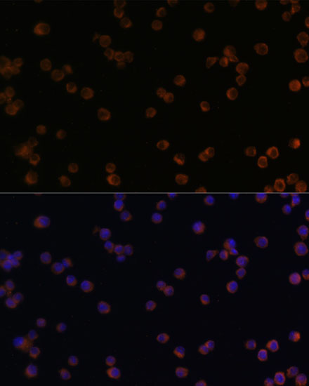 CHI3L1 antibody