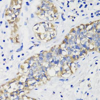 DEPDC6 Polyclonal Antibody
