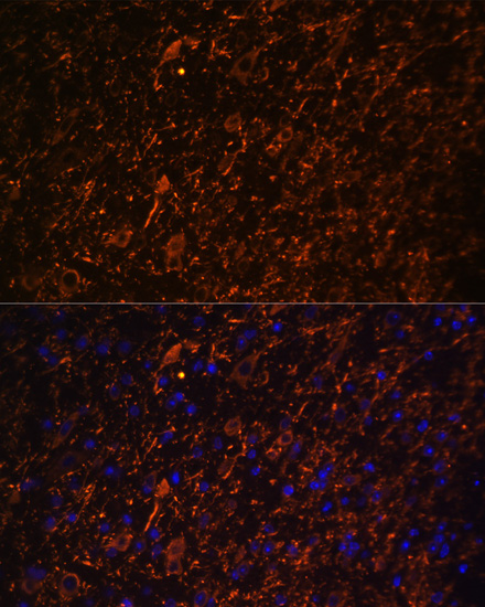 MAP2 Antibody