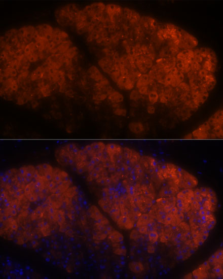 PNLIPRP1 Polyclonal Antibody
