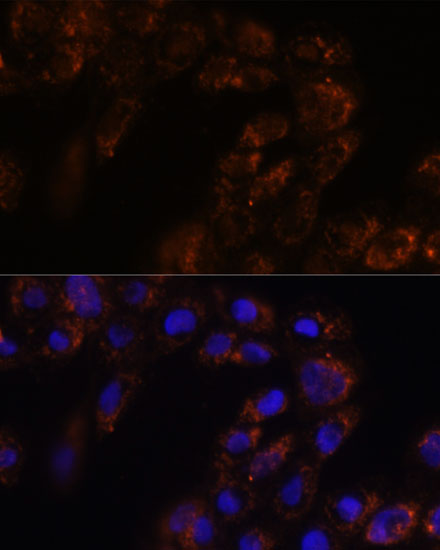 TMED3 Rabbit Polyclonal Antibody