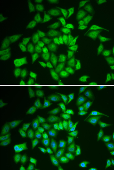 CSNK1E antibody
