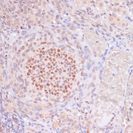 Acetyl-Histone H3-K23 pAb