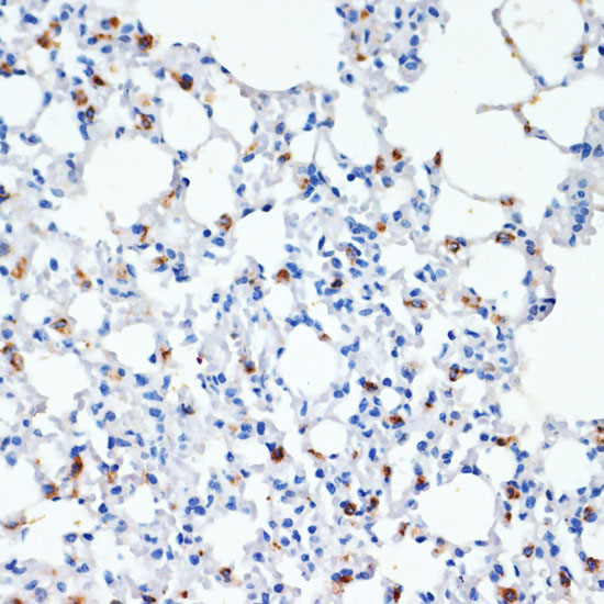 SFTPC Antibody
