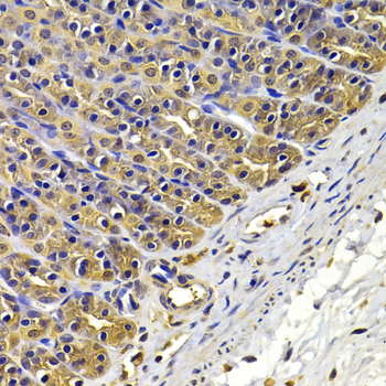 FSCN1 Polyclonal Antibody