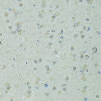 TRIM28 Rabbit Polyclonal Antibody