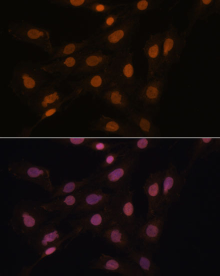 CBX3 Polyclonal Antibody