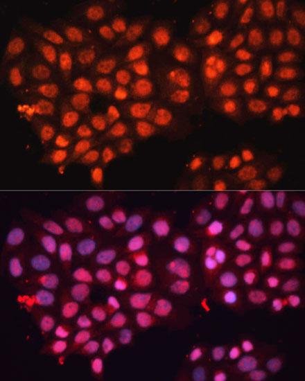 ABCB8 Rabbit Polyclonal Antibody