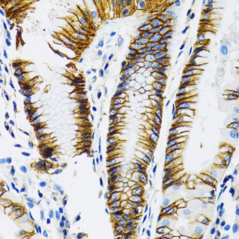 SLC16A1 antibody