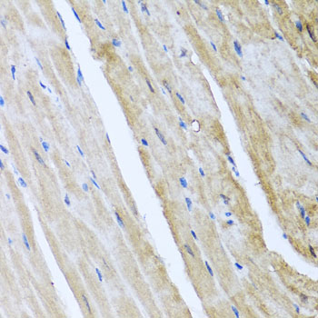 CAMK2G Rabbit Polyclonal Antibody