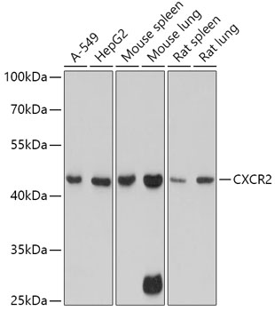 CXCR2 Rabbit Polyclonal Antibody