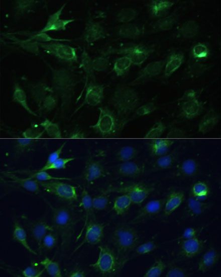 COX6A1 Polyclonal Antibody