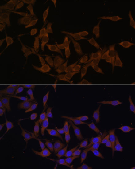 UBE2L3 Polyclonal Antibody