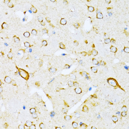 VARS Polyclonal Antibody