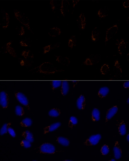 TRAP1 Rabbit Polyclonal Antibody