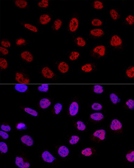 BCAS2 Rabbit Polyclonal Antibody