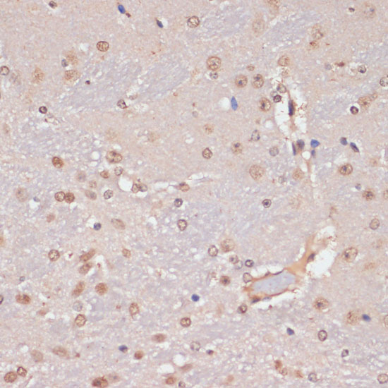 PIDD Polyclonal Antibody