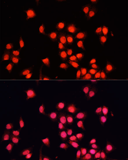 BACH1 antibody