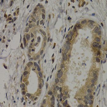 MAGEA1 antibody