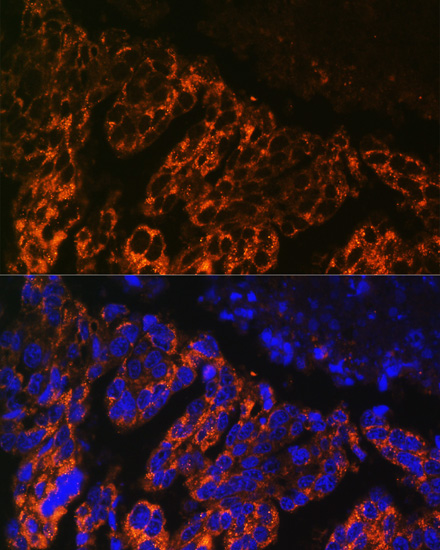 SCNN1A Rabbit Polyclonal Antibody