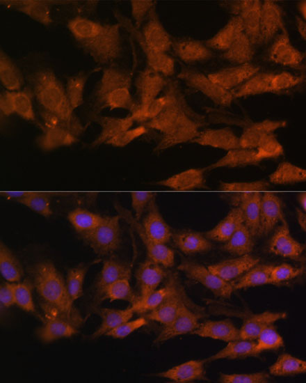 DDX3X Antibody