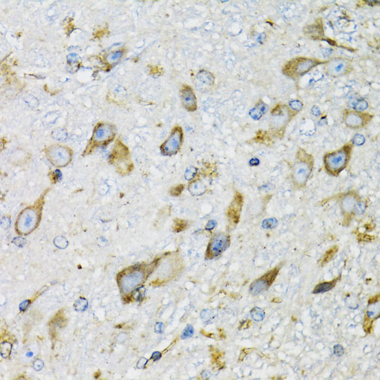 PDYN Polyclonal Antibody