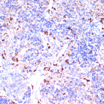 GATM antibody