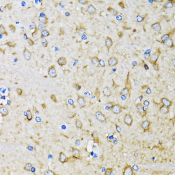 LC3B Polyclonal Antibody