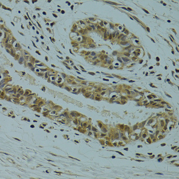 RSRC1 Polyclonal Antibody