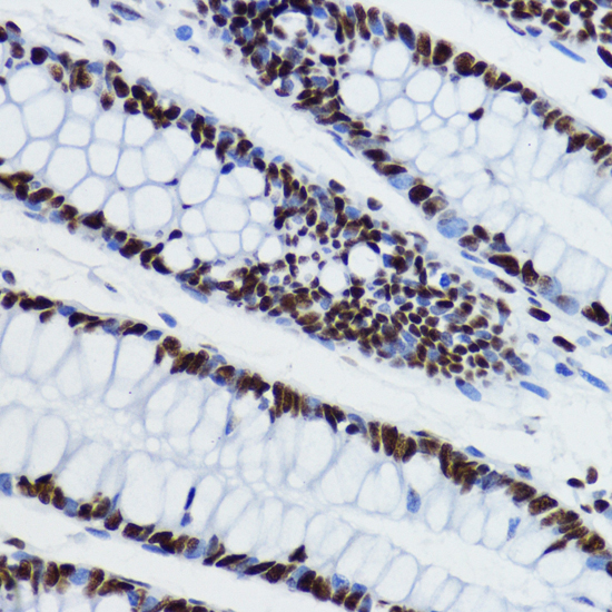 Histone H3K27AC antibody