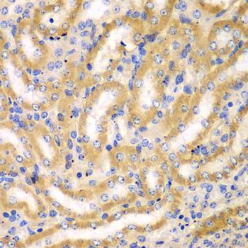 BCAS3 Rabbit Polyclonal Antibody