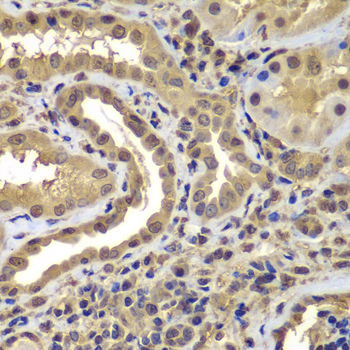 PSMB8 Rabbit Polyclonal Antibody