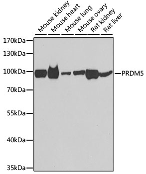 PRDM5 Rabbit Polyclonal Antibody