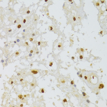 HNRNPA1 Polyclonal Antibody