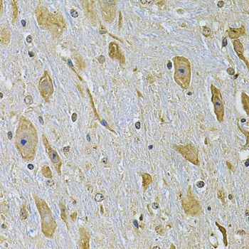 ITGA2 Polyclonal Antibody