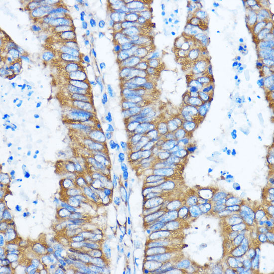 YBX1 Polyclonal Antibody