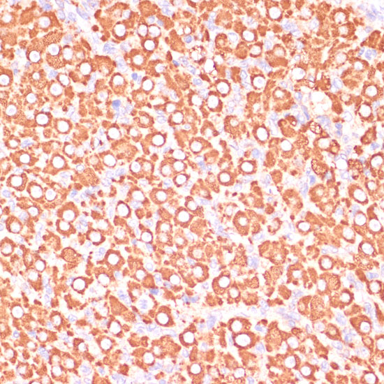 MAP2K3 Polyclonal Antibody
