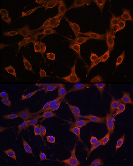 SQSTM1 / p62 Polyclonal Antibody