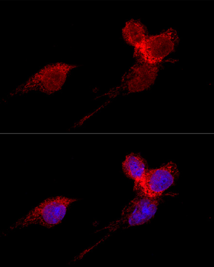 RPL36 Rabbit Polyclonal Antibody