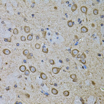 CDH16 Rabbit Polyclonal Antibody