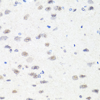 CHD1 Polyclonal Antibody