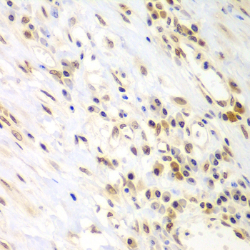 LHX4 Polyclonal Antibody