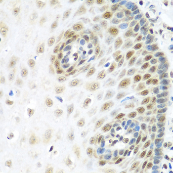 MDC1 Rabbit Polyclonal Antibody