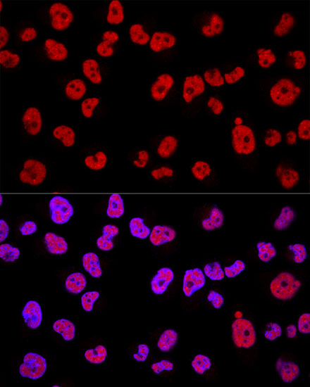 METTL3 Polyclonal Antibody
