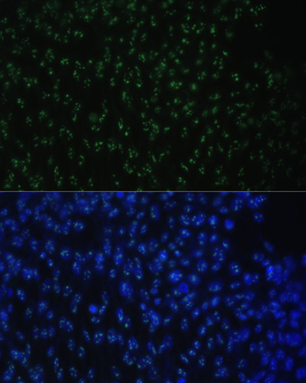 DDX50 Rabbit Polyclonal Antibody