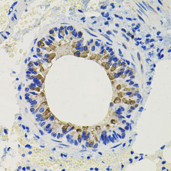 CALB2 Rabbit Polyclonal Antibody