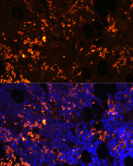 GPR55 Rabbit Polyclonal Antibody