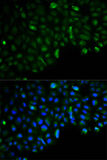 HK2 Antibody